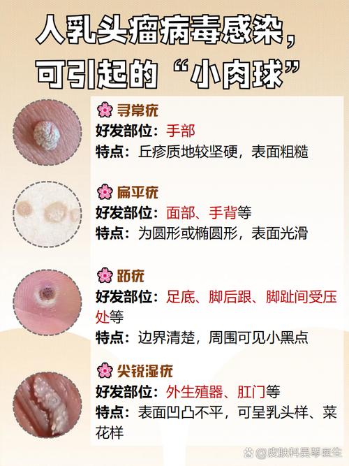 皮肤长小肉粒是何原因?