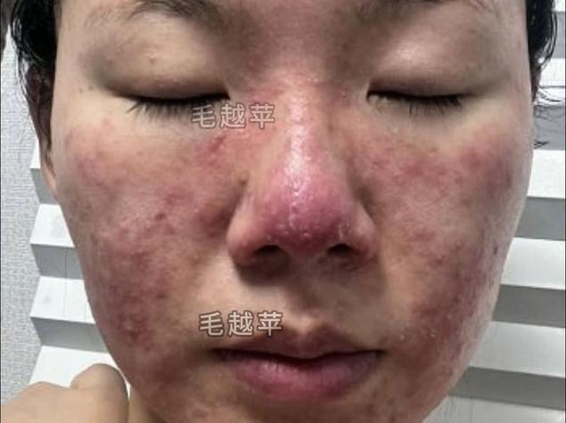 不洗脸真能让皮肤变好?