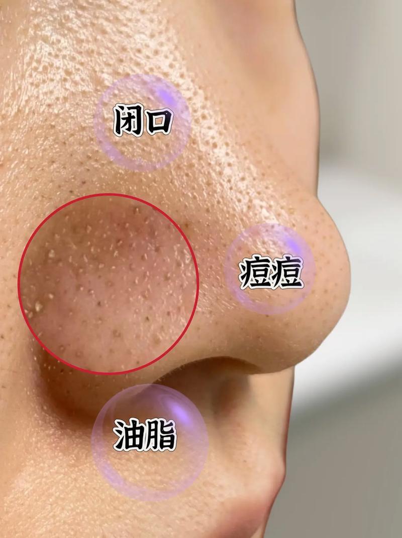 不洗脸真能让皮肤变好?