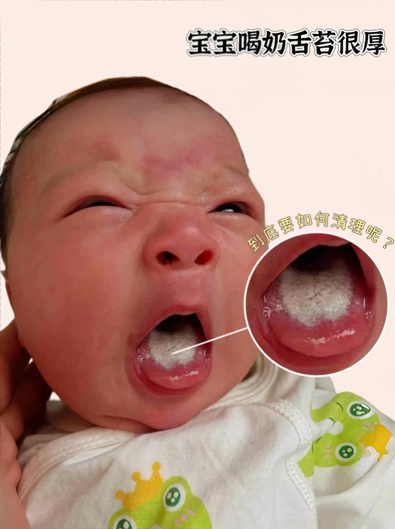 四个月宝宝口腔内照正常吗?