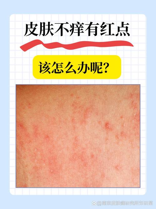 皮肤过敏能用马油吗?