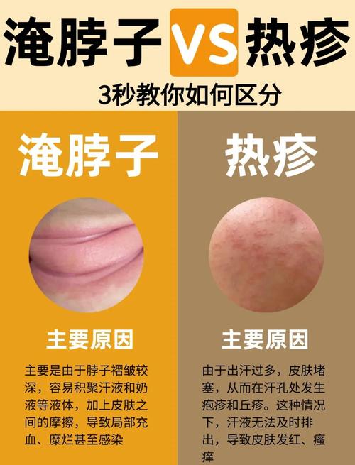 皮肤过敏洗热水澡会加重吗?