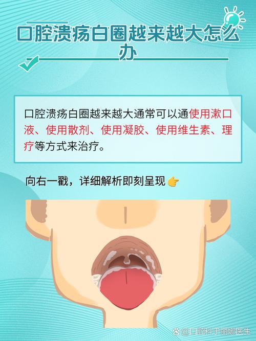 口腔溃疡能打预防针吗