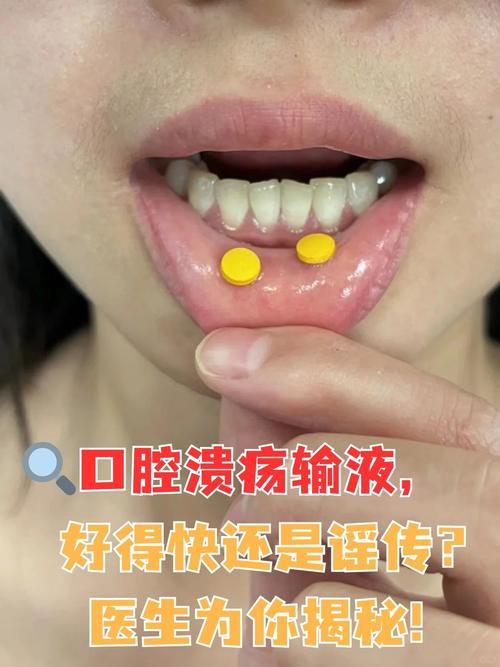漱口腔内壁疼,是漱口水的错吗?