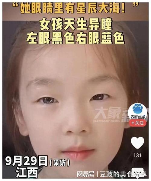 天生皮肤黑女儿如何改善?