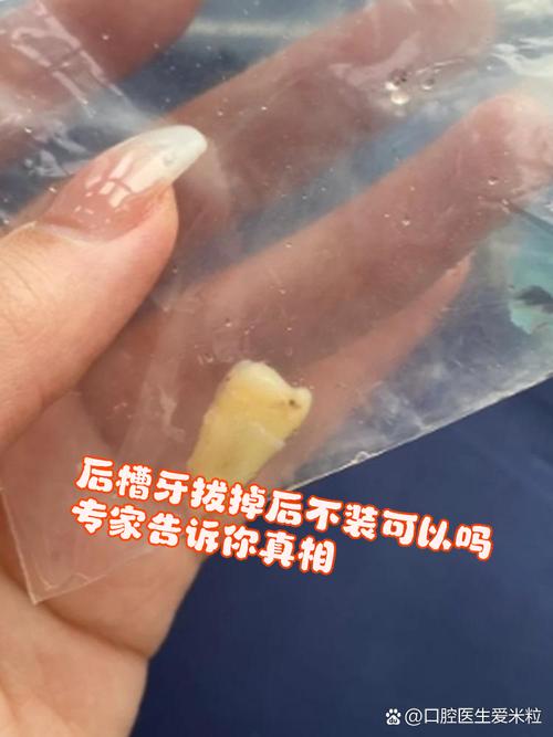 拔牙6天洞里食物残渣怎么办?