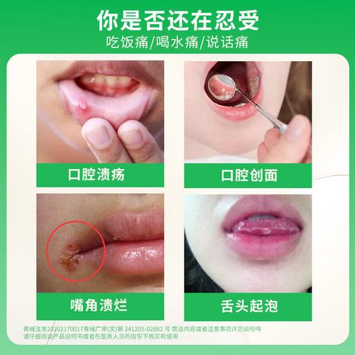 徐州市黄氏口腔擦的药