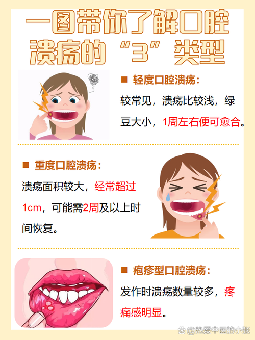 一直口腔溃疡什么原因