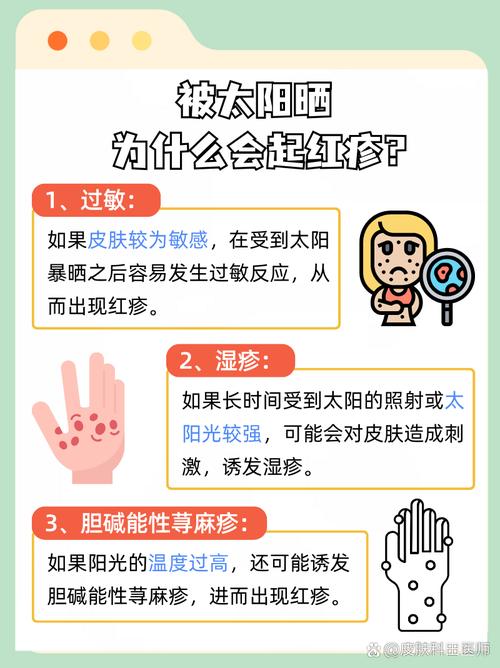 晒皮肤过敏怎么办?