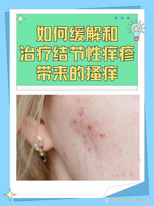 吃结核药皮肤痒是否正常?