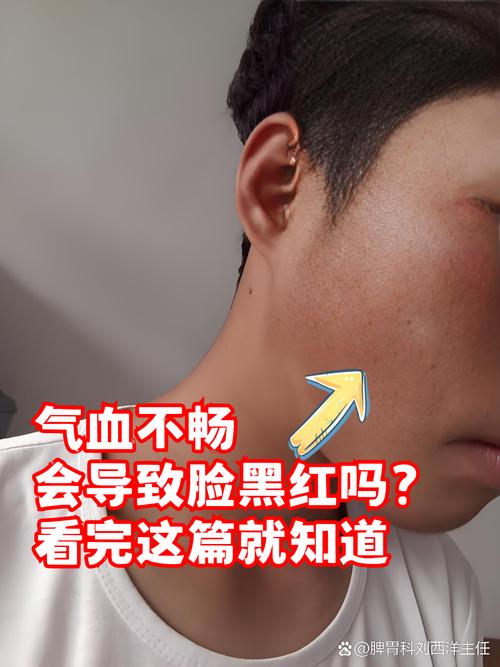 红外线会让皮肤变黑吗?