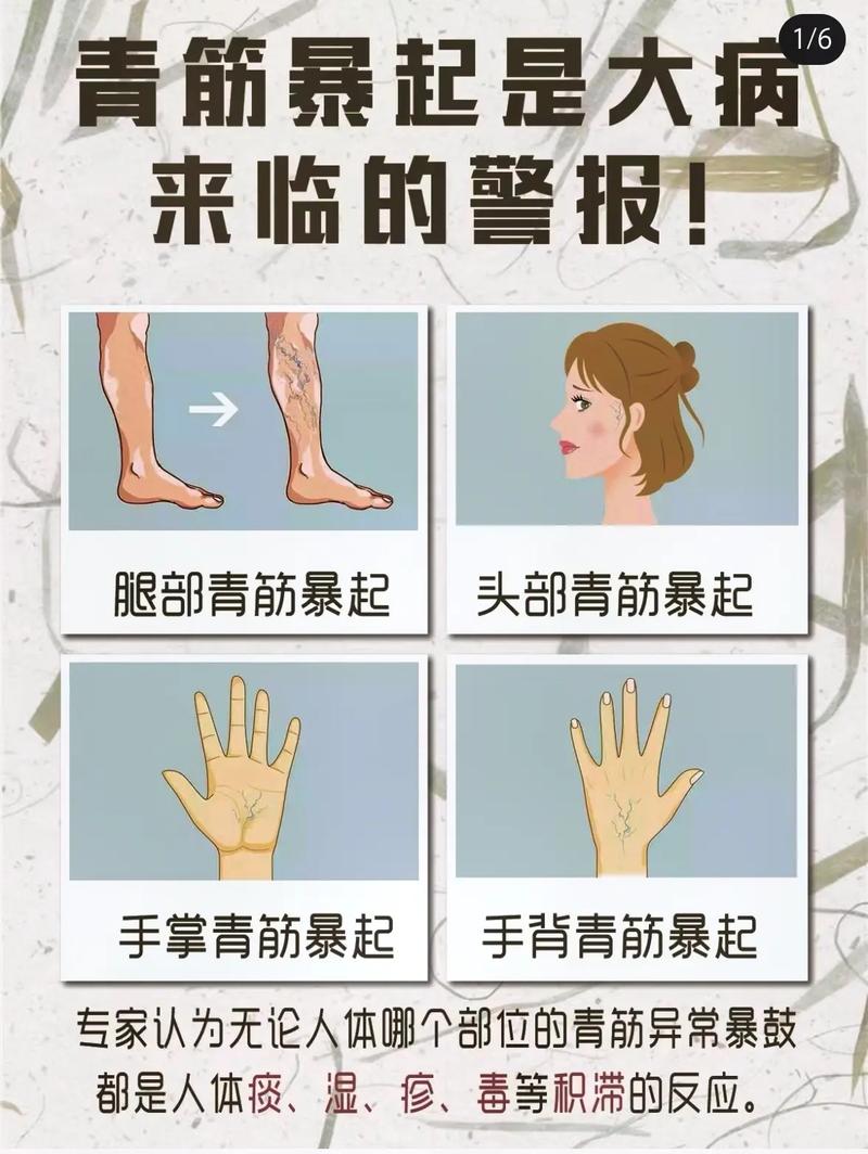 皮肤易青是何原因?