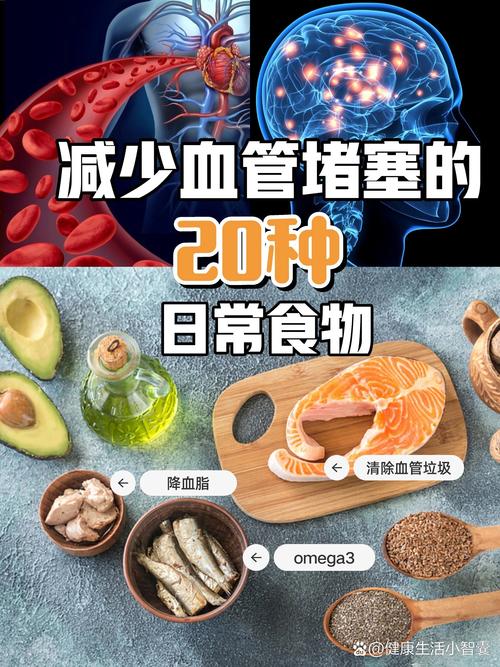 哪些食物能最有效预防动脉粥样硬化?
