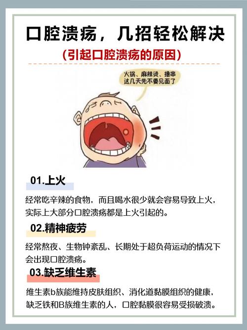 舌头溃疡疼得厉害,怎么快速好?