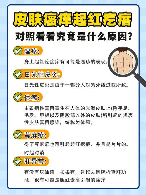 晚上皮肤总痒,是缺水还是过敏?