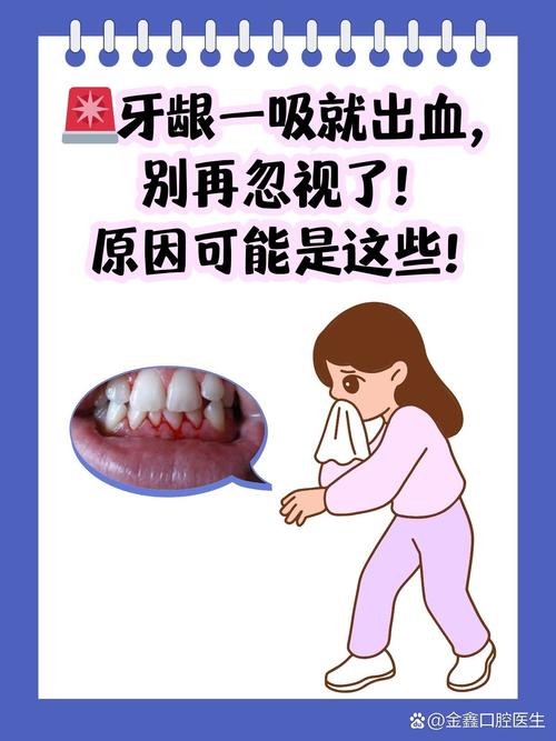 口腔一直出血,是牙龈炎还是全身疾病?