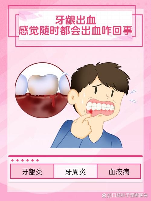 口腔一直出血,是牙龈炎还是全身疾病?