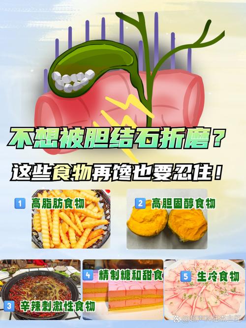 胆囊结石患者哪些食物不能吃?