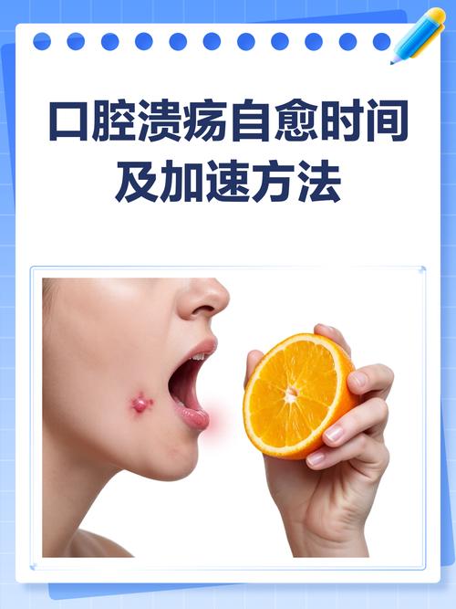 口腔溃疡一般多久能好?