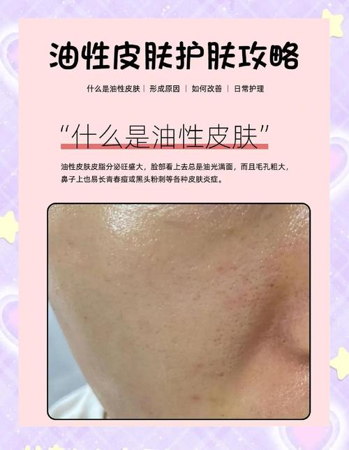 油性皮肤过度洗脸会伤肤吗?