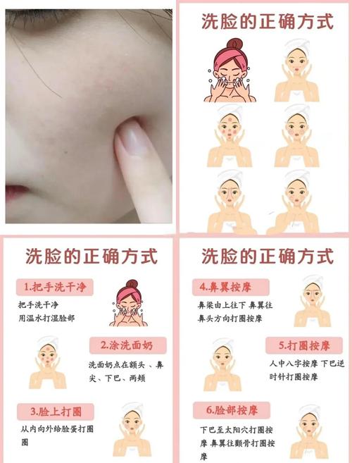 油性皮肤过度洗脸会伤肤吗?