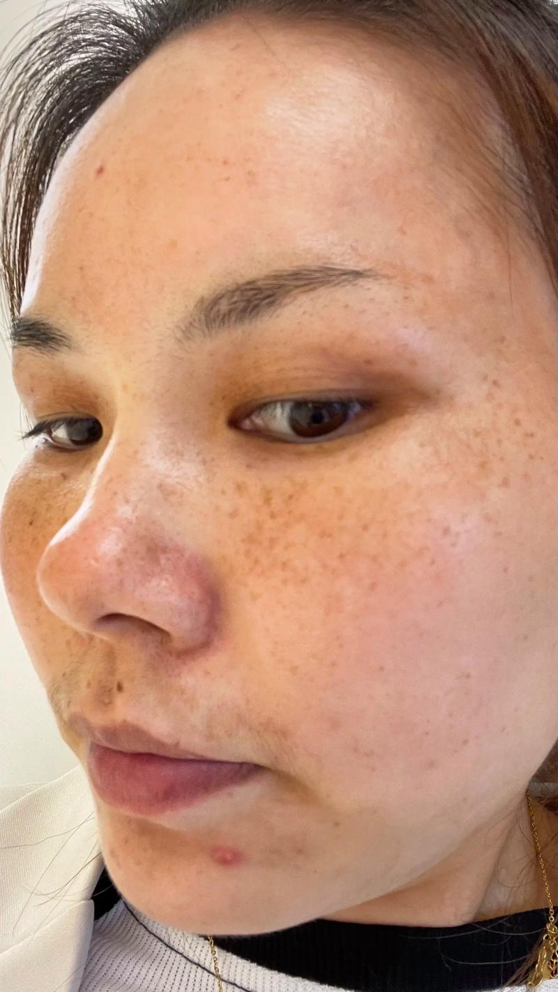 皮肤为何从白变黄?