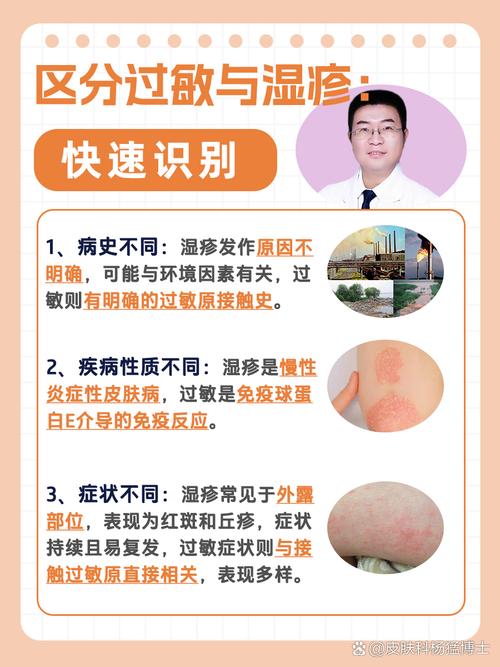 皮肤过敏和湿疹究竟有何不同?