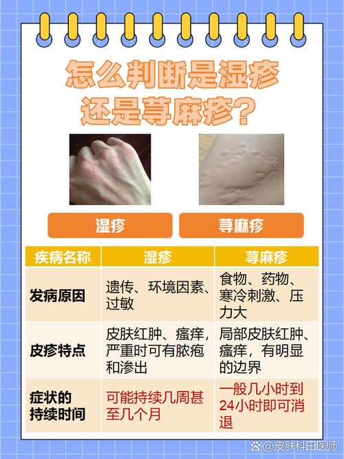 皮肤过敏和湿疹究竟有何不同?