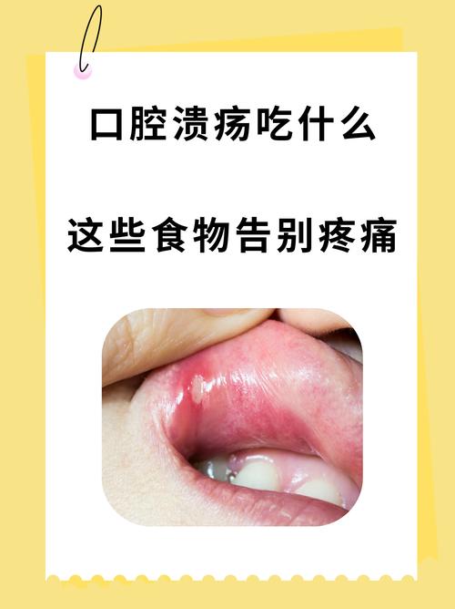 孩子口腔溃疡,吃什么饭能好得快?