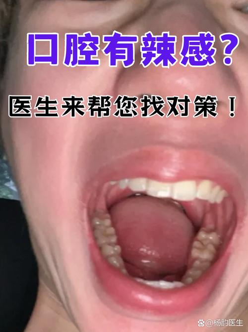 口腔溃疡吃辣椒会加重疼痛吗?
