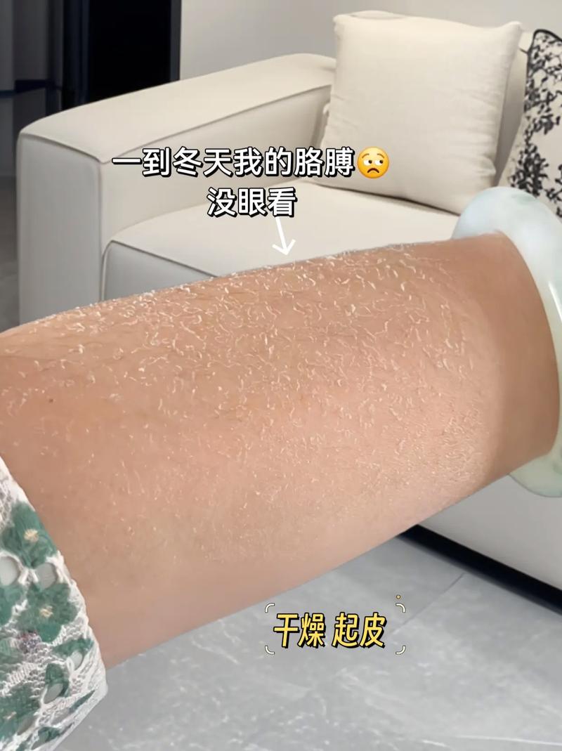 皮肤干燥起皮,吃这些真能改善吗?