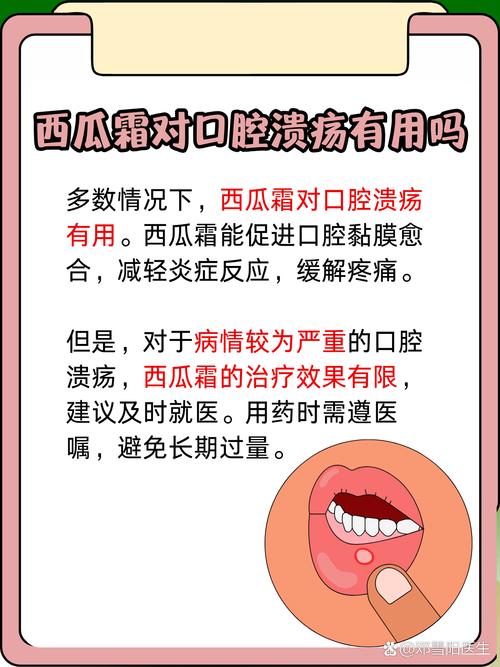 口腔溃疡吃西瓜霜含片管用吗?
