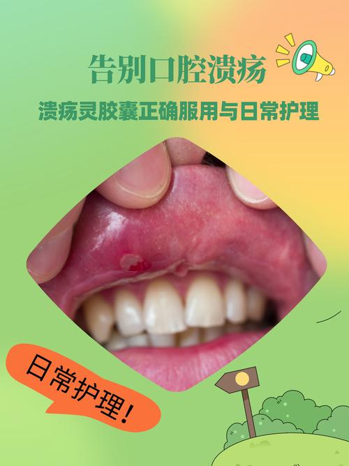 补牙后口腔溃疡是材料刺激还是感染?