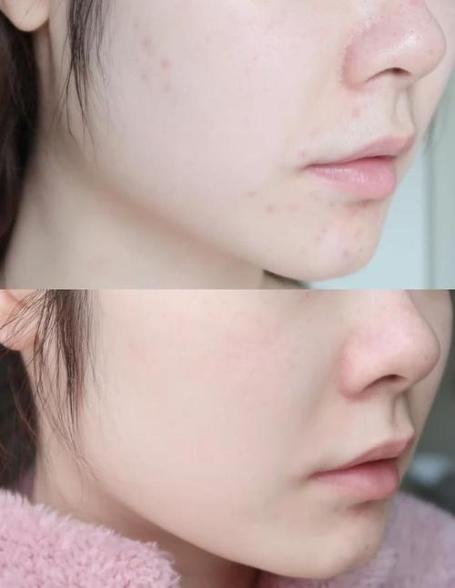 20岁皮肤显老?原因何在?