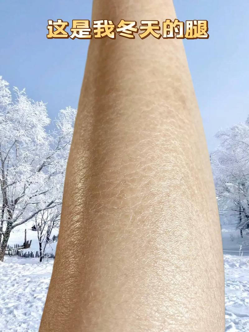 20岁皮肤显老?原因何在?