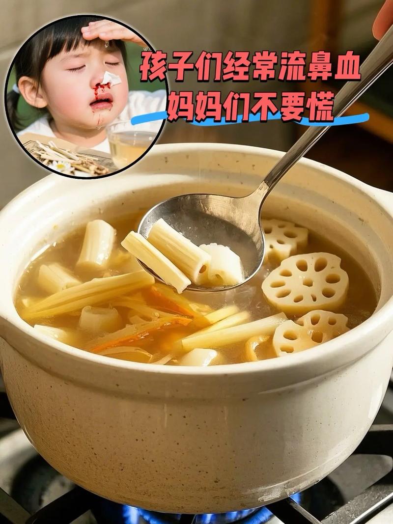 宝宝流鼻血吃什么能快速止血?