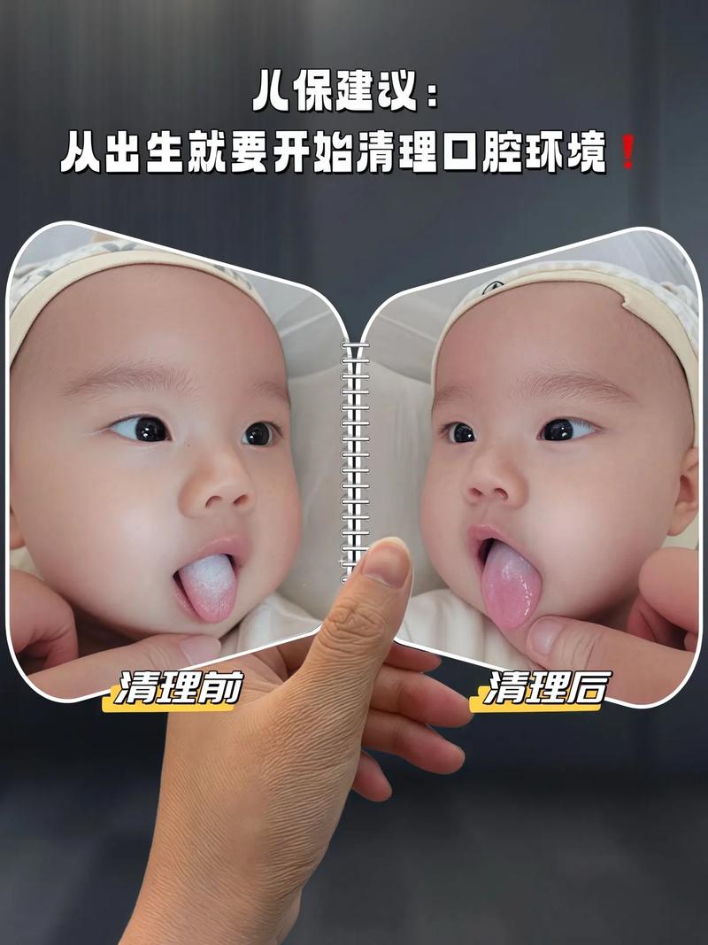 新生儿口腔清洁到底该不该做?