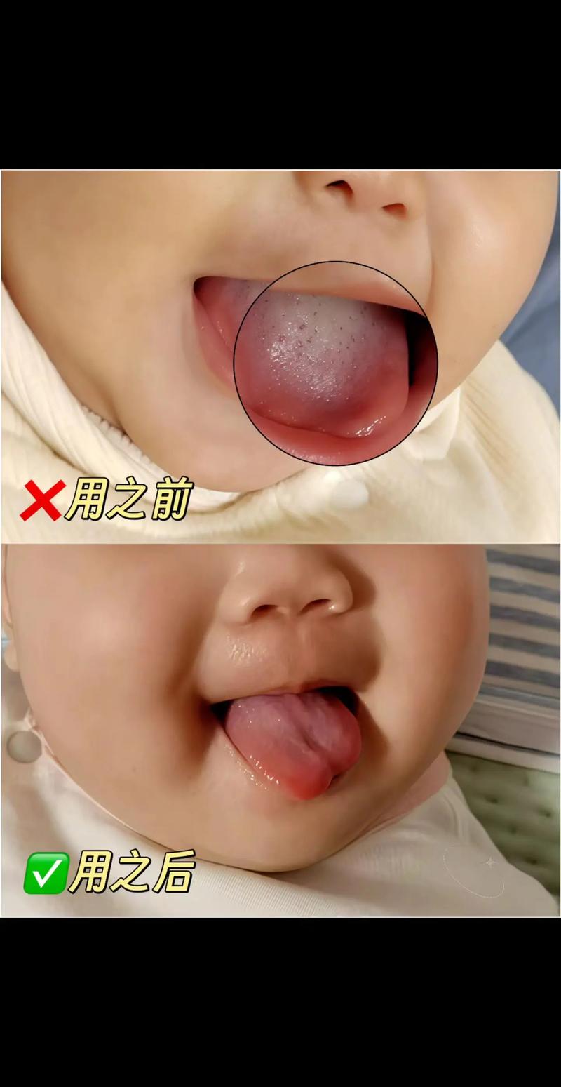 新生儿口腔清洁到底该不该做?