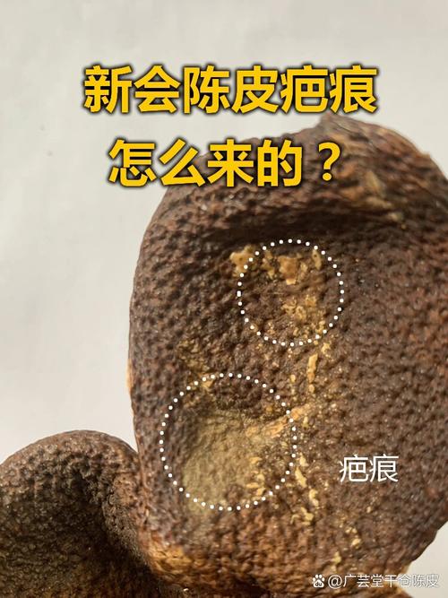 橘子皮皮肤还能恢复吗