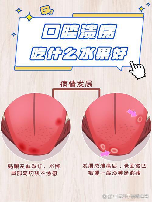 口腔溃疡吃番茄有用吗