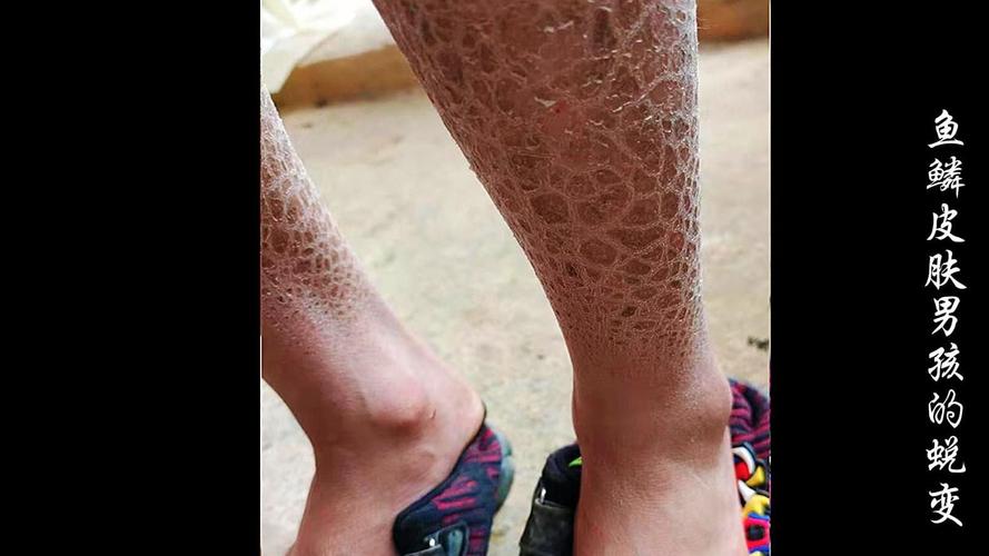 身上有鱼鳞的皮肤图片