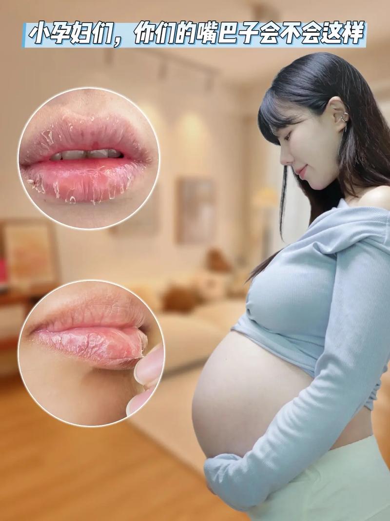 怀孕皮肤干燥能判断生男生女吗?