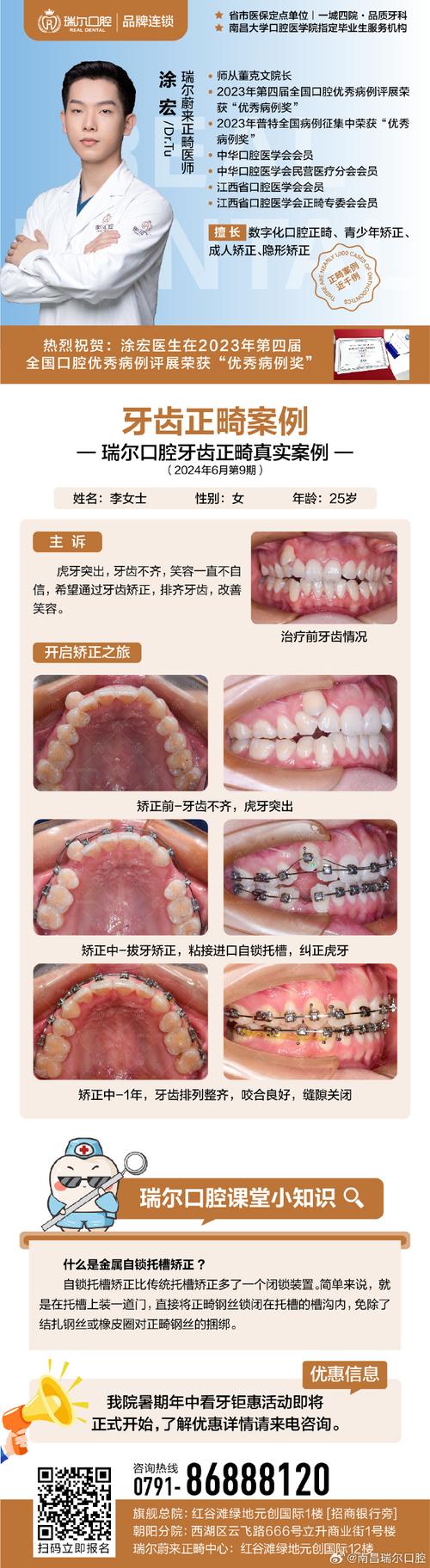 口腔科正畸具体指什么治疗?
