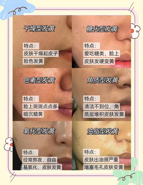 先天黑皮肤如何有效变白?