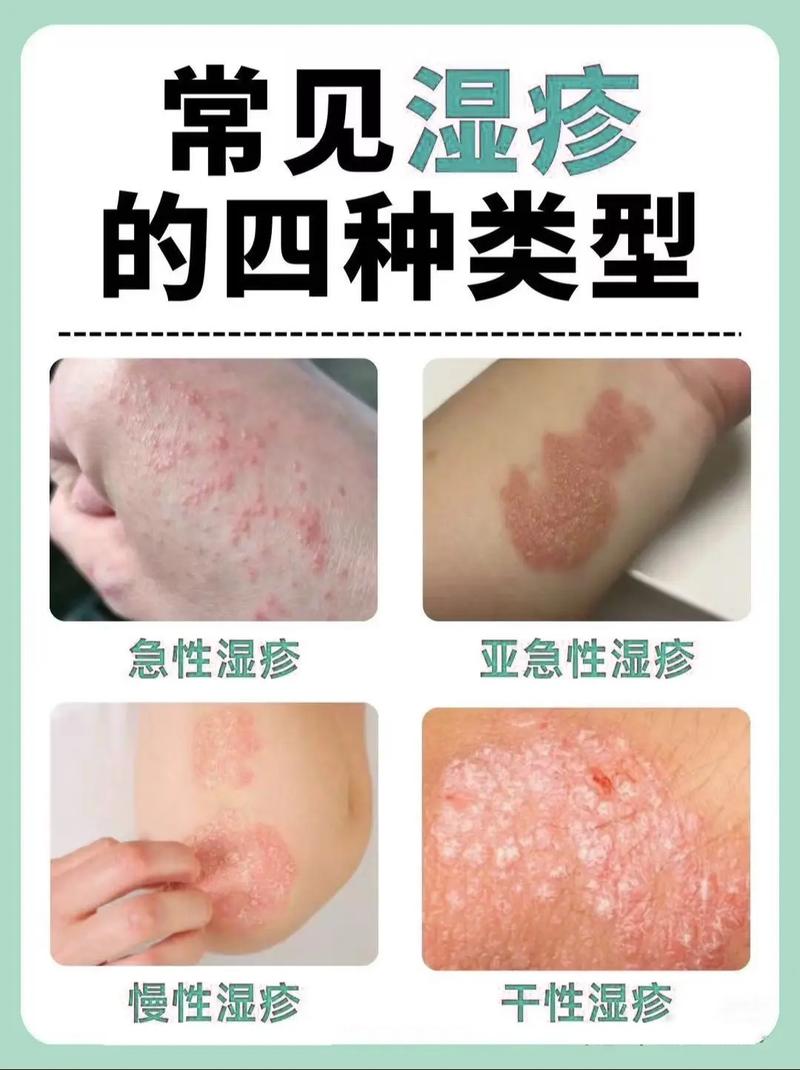 皮肤痒痒是过敏还是其他问题?