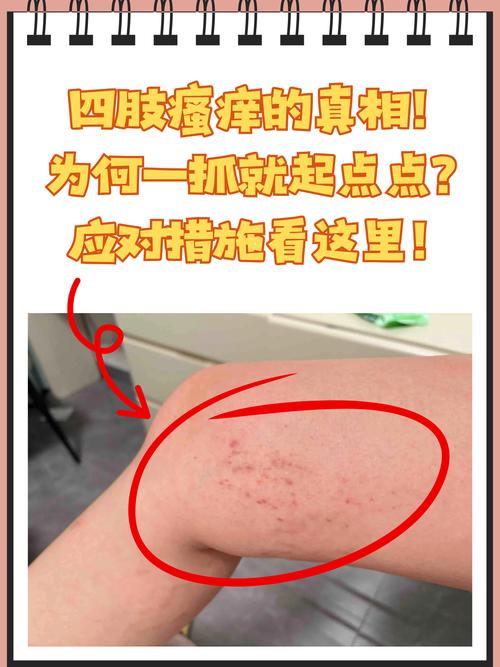 皮肤痒痒是过敏还是其他问题?
