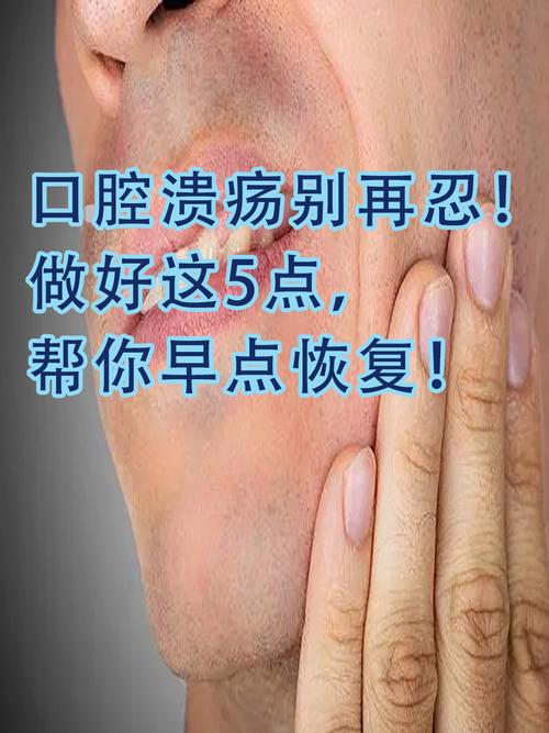 容易出口腔溃疡怎么办