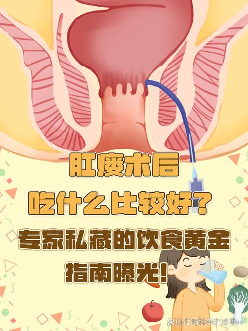 肛瘘术后饮食,这些食物能促进恢复吗?