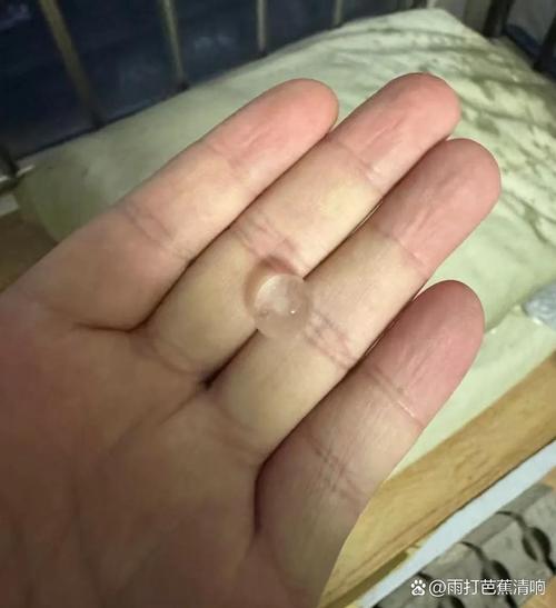 漱口水用后口腔黏膜脱落,是正常反应吗?