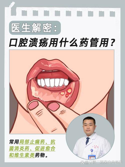 唇内侧口腔溃疡如何快速止痛?